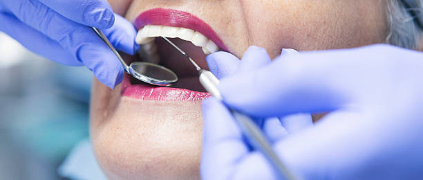 Best Knocked-Out Tooth Emergency  in Atwood, TN